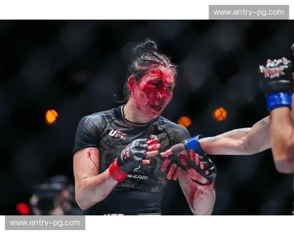 新闻UFC—让每一次出拳都成为头条 新闻UFC—让每一次出拳都成为头条